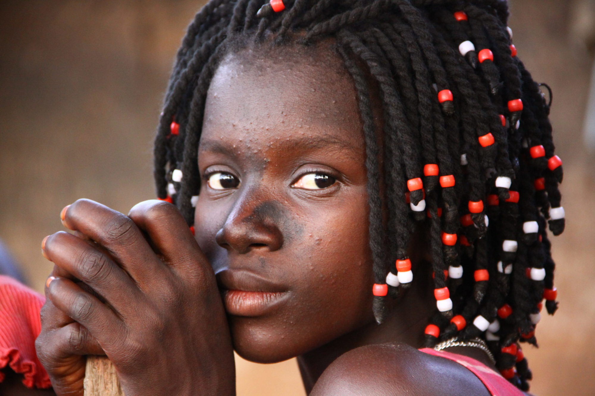 Amici della Guinea Bissau Odv